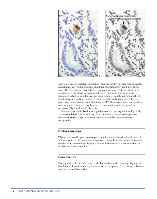 Atlas of gastrointestinal endoscopy and related pathology (blackwell,…