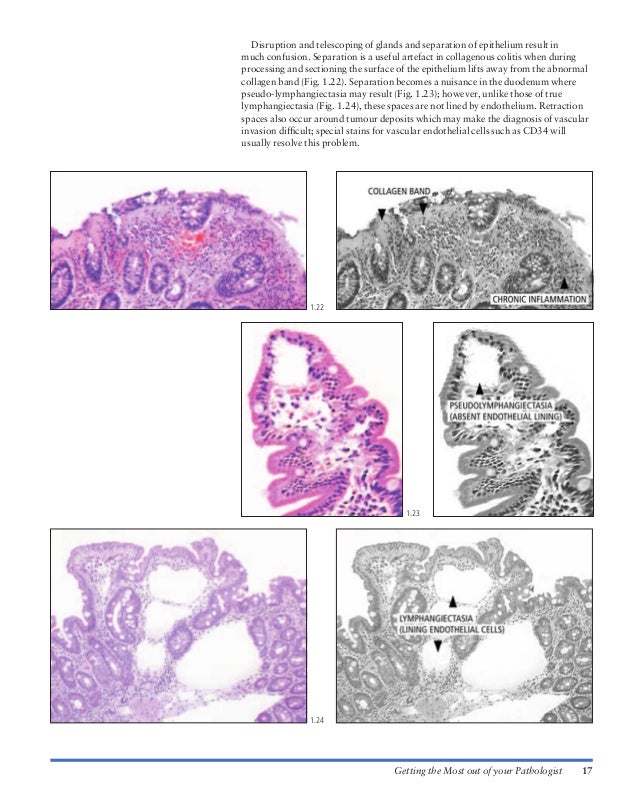 Atlas of gastrointestinal endoscopy and related pathology (blackwell,…