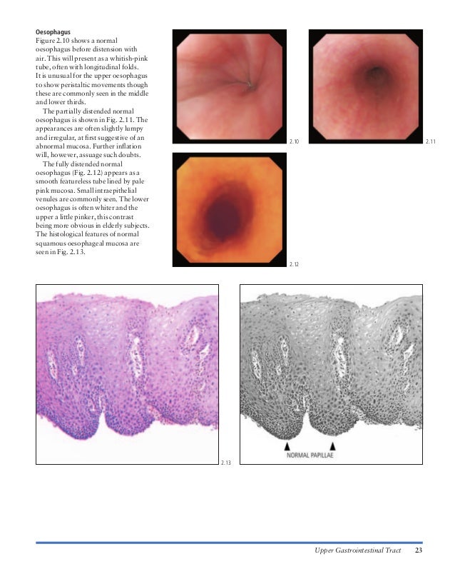 Atlas of gastrointestinal endoscopy and related pathology (blackwell,…