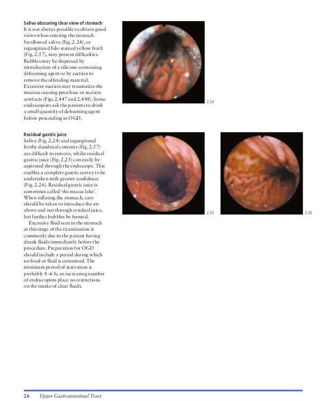 Atlas of gastrointestinal endoscopy and related pathology (blackwell,…