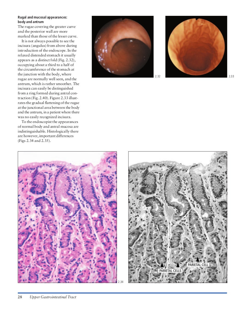 Atlas of gastrointestinal endoscopy and related pathology (blackwell,…