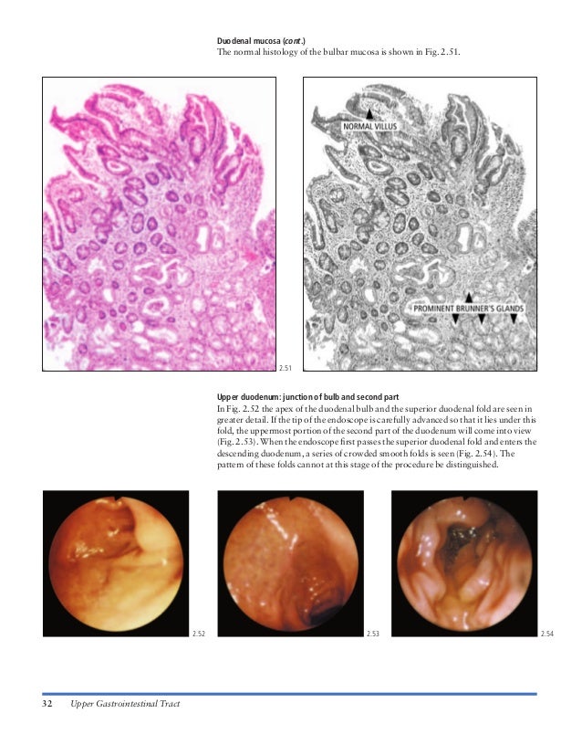 Atlas of gastrointestinal endoscopy and related pathology (blackwell,…