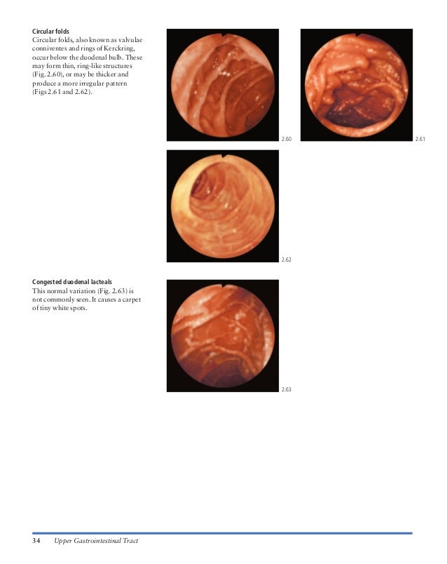 Atlas of gastrointestinal endoscopy and related pathology (blackwell,…