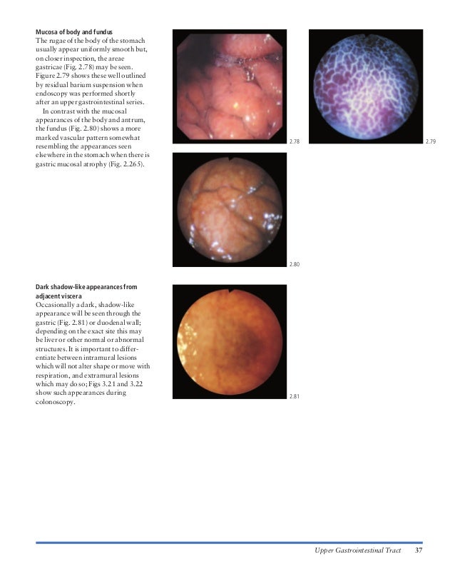 Atlas of gastrointestinal endoscopy and related pathology (blackwell,…