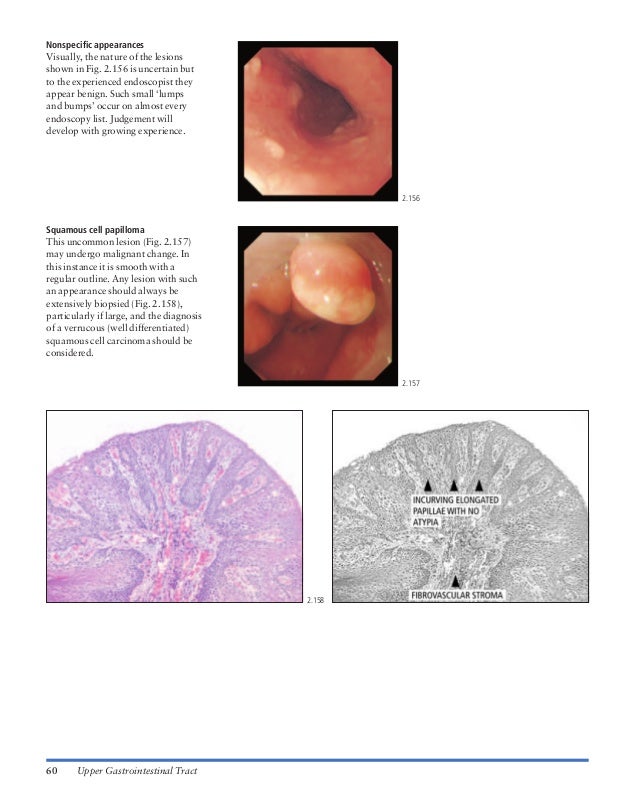 Atlas of gastrointestinal endoscopy and related pathology (blackwell,…