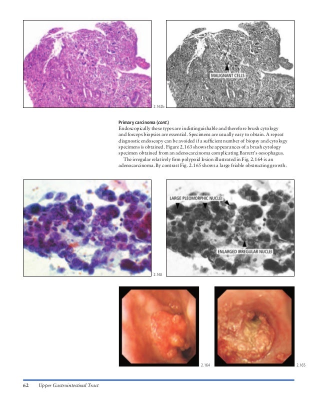 Atlas of gastrointestinal endoscopy and related pathology (blackwell,…