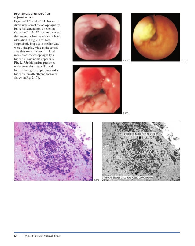Atlas of gastrointestinal endoscopy and related pathology (blackwell,…