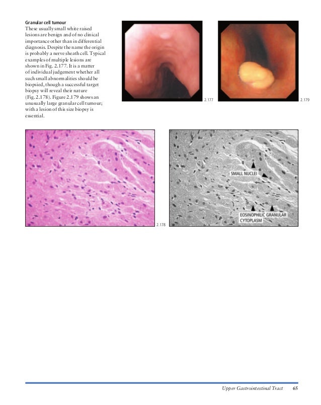 Atlas of gastrointestinal endoscopy and related pathology (blackwell,…
