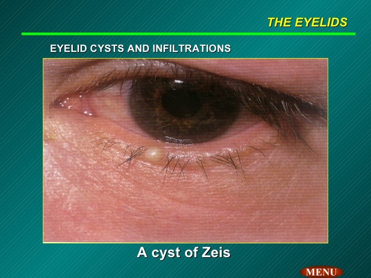 Atlas of opthalmology_tanta_university