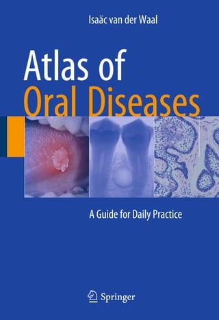 Atlas of
Oral Diseases
Isaäc van der Waal
A Guide for Daily Practice
123
 
