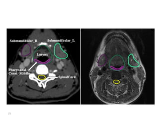 Atlas of organs at risk delineation head and neck region | PDF