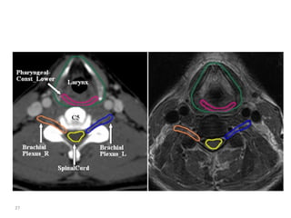 Atlas of organs at risk delineation head and neck region | PDF