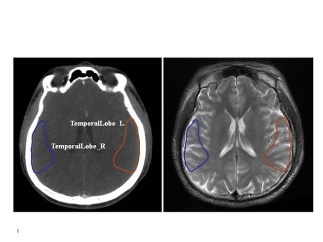 Atlas of organs at risk delineation head and neck region | PDF