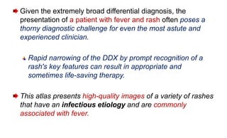 Targetoid Rash Ddx Atlas of Rashes Associated with Fever.pptx