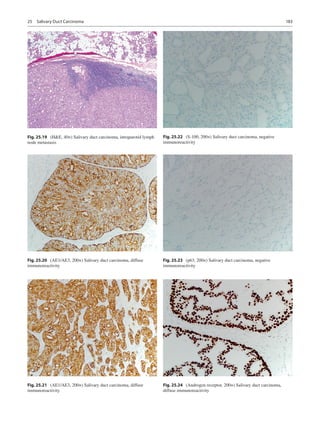 Atlas of salivary gland pathology
