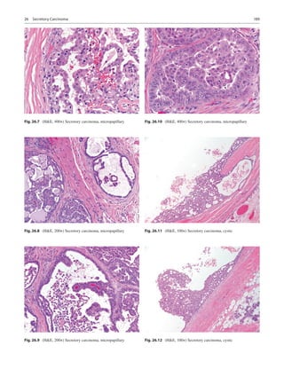 Atlas of salivary gland pathology