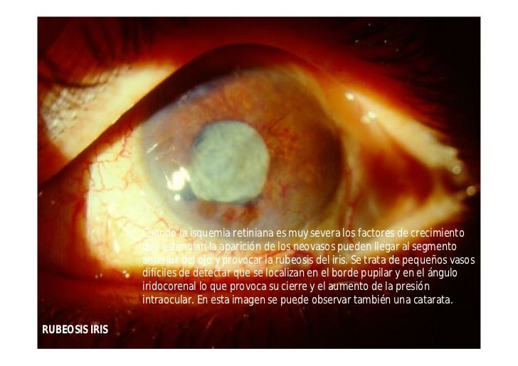 Atlas oftalmología