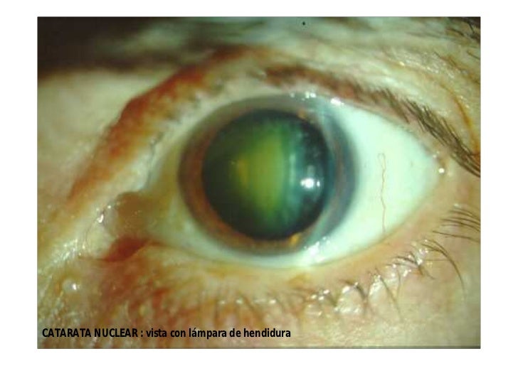 Atlas oftalmología
