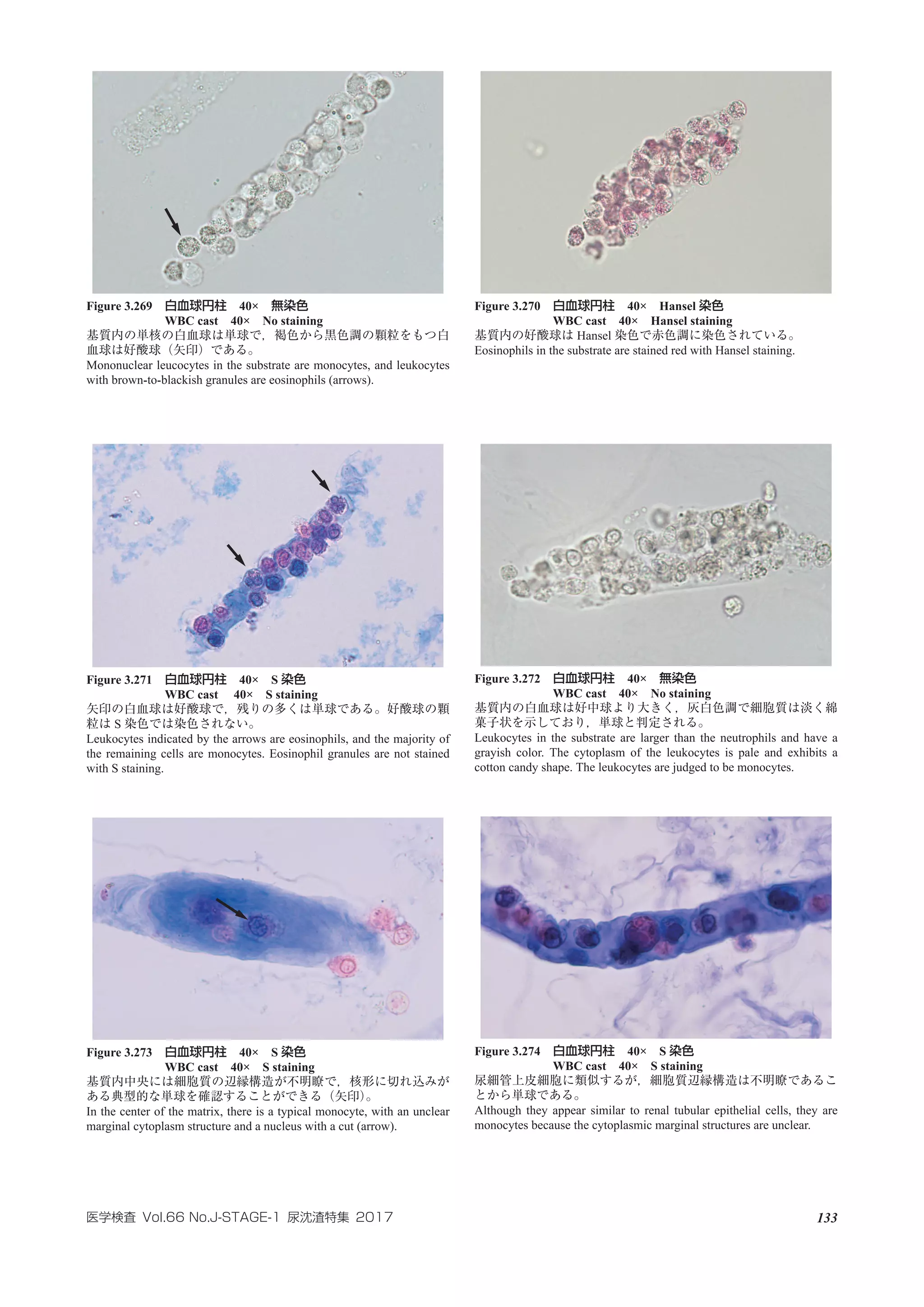 Atlas of urinary_sediment | PDF