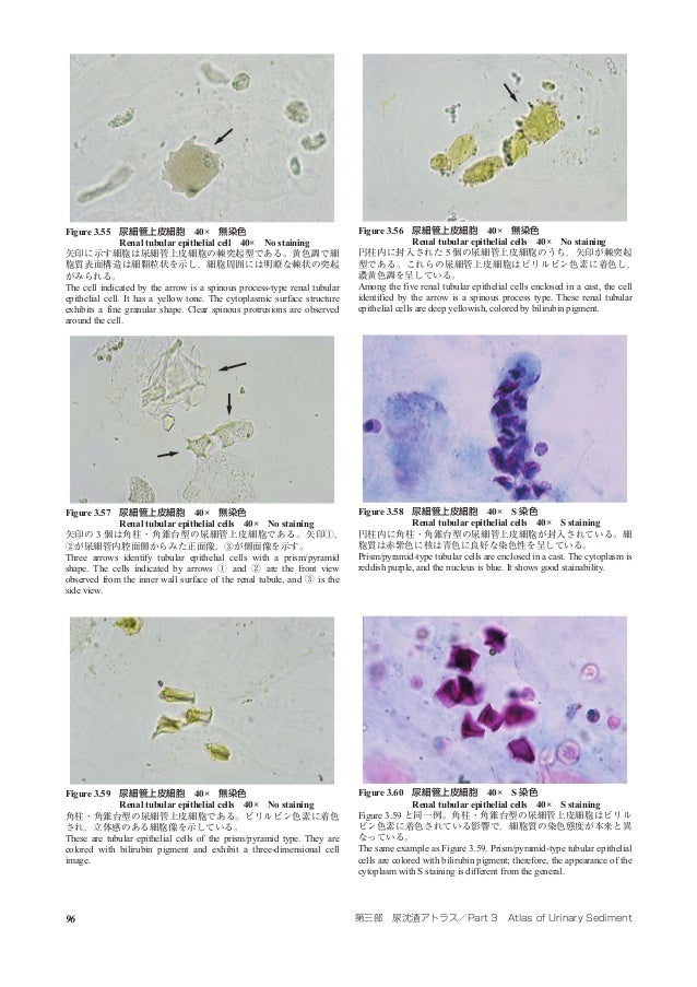 Atlas Of Urinary Sediment
