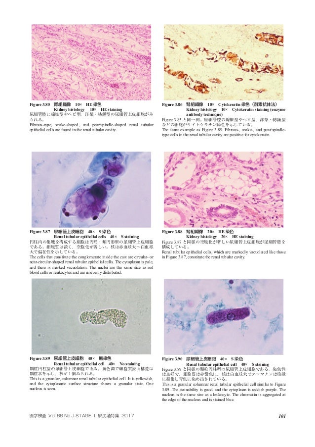 Atlas Of Urinary Sediment