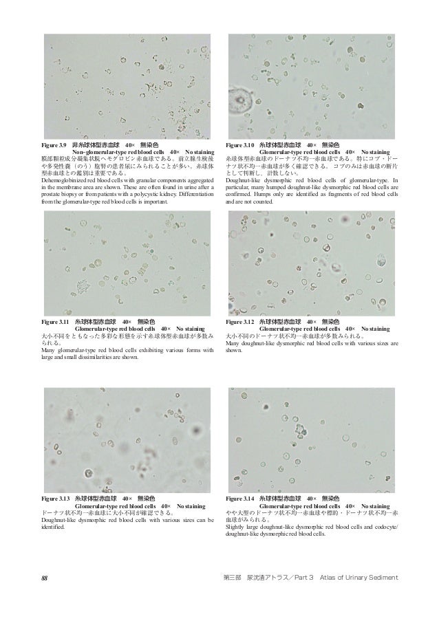 Atlas Of Urinary Sediment