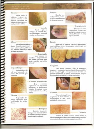 Fissura
Perda linear da
epiderme é derme com
paredes verticais e bem
definidas (rachaduras das
mãos e pés, intertrigo, ecze-
ma da ponta dos dedos).
Atrofia
Atrofia - pele se
adelgaça, se tornando fina,
lisa, translúcida e pregueada
(estrias, envelhecimento)
Escoriação
Lesão causada por
coçadura e frequentemente
são lineares (escabiose, pele
seca, prurido, dermatite
atópica).
Ceratose ou queratose
Espessamento
superficial da epiderme
decorrente da proliferação
exclusiva da camada córnea
(queratodermias, calos,
cravos).
Petéquias
Depósito circunscrito
de sangue com menos de 0,5 em
de diâmetro (meningococcemia,
casculiteleucocitoclástica).
Púrpura
Mancha ver-
melho-violácea, forma-
da pelo extravasamento
de hemáceasna derme.
Úlcera
Perda focal da epiderme e
derme. Deixando cicatriz após a
cura - (aftas,isquêmica, sífilis(can-
cro), dermatite por radiação,úlceras
de estase,neoplasias).
Liquenificação
Espessamentos da
pele com acentuação das
estrias. Pele induzida por
coçaduras.
Cicatriz
Reposição do
tecido destruído pela
proliferação do tecido
fibroso.
Telangiectasia
Dilatação dos vasos
sanguíneos superficiais
(artérias ou veias de pequeno
calibre), Dilatação da prega
unguealproximal.
Erosão
Perda focal.da epiderme. Não deixa cicatriz após a
cura (candidíase, herpes, simples, pele senil, infecção por
dermatófito, eczemas).
Gangrena
Uma necrose isquêmica (falta de suprimento
sanguineo,e consequente falta de oxigénio)das extremidades
(braço, mão, perna, pé) e consequente morte de tecido. Um
processo necrotizante, e quando ocorre na pele, em geral
envolveaderme, aepiderme eo tecido subcutâneo.
Urticária
Uma reação da pele com
surgimento de placas elevadas e
avermelhadas na pele, acom-
panhadas de muitacoceira.
Comedão
Acúmulo de gordura e células córneas dentro do
folículopilossebáceo, provocando o aparecimento de pontos
negros principalmente no rosto, costas,peito e ombros.
 