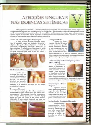 . ~..-' ~
,,"r;":'~";
< ~.'
~-::~
. .
AFECCOES UNGUEAIS
NAS DOENCAS SISTÊMICAS
A função primordial das unhas é a proteção. As doenças ungueaispodem estar associadas a várias doenças de pele e/ou
doenças sistêmicasou ocorrer após trauma externo ou ser efeito adverso a uma medicação.As alteraçõesungueais podem ocorrer
devido às anormalidades da matriz ou vasculares. As anormalidades que fazem parte desse enigma e, que estão presentes, no
aparelho ungueal são úteis como meio de diagnóstico das doenças sistêmicas.Neste trabalho, revemos nas unhas os sinaismais
comuns, que podem auxiliar-nosno diagnóstico de doenças sistêmicas.
Unhas em vidro de relógio - Acropaquia
As unhas em vidro de relógio (unhas em baqueta,
bico de papagaio) podem ser familiares, idiopáticas e
adquiridas. Em geral, a forma adquirida é o resultado de
patologias pulmonares, cardíacas, hepáticas ou
gastrointestinais. É definido como hiperplasia do tecido
fibrovascular,com uma mobilidade anormal da base da unha
que pode deslocar-se para frente e para trás, dando a
impressão que flutua.
Sindrome Das Unhas Amarelas
Afecção rara e
acredita-se que seja uma
anomalia linfática, falha no
sistema imune e derrame
pleural. Os achados
principais são alterações
distróficas, coloração
amarelada e as mudanças das unhas vão do amarelo
esverdeadoaté o marrom.
Doença de Raynaud
É uma condição que afeta o fluxo sanguíneo nas
extremidades do corpo humano, mãos, pés, dedos, mas a
patogenia exata é desconhecida. Observa-se primeiramente
uma coloração branca (vasoespasmo arteriolar digital),
seguida por uma cor azulada e por último vermelha
(hiperernia). É uma moléstia funcional, que surge em
pacientes hipersensíveisao frio ou por estresse emocional.
Doença de Darier
Conhecido como
"Ceratose Folicular". É uma de-
sordem genética rara genoder-
matose) autossômica dominan-
te, que se caracteriza por uma
alteração de queratinização. Se
agravano verão devido ao calor e
umidade e exposição à luz solar. No hiponíquio, podem se
observar pápulas hiperqueratósicas subungueais, hiperplasia
epitelialdo leito ungueal,leuconíquia total daunha.
Unhas de Terry ou Leuconíquia Aparente
(Meio-a-Meio)
É provavelmente
devido à diminuição da
vascularizaçãoe aumento do
tecido conectivo no leito
ungueal. Ocorre geralmente
em situações de insuficiência
hepática, renal, cirrose, dia-
betes, insuficiência cardíaca
congestiva, hipertireoidisrno e/ou desnutrição. Se apresenta
na cor normal na parte distalebranca na parte proximal.
Traquioníquia - Unhas
Rugosas
Superfície rugosa,
áspera, acinzentada em todo o
corpo da unha. Tem-se a
sensação de que as unhas
foram polidas com areia. Está
associada com psoríase, líquen
plano, e com a alopéciaareata.
Linhas Duplas Brancas de Muehreke
Sãobandas esbran-
quiçadas, paralelas à lúnula,
no leito ungueal, com uma
coloração rosada entre as
duas linhas brancas. Estão
associadas a hipo albu-
minemia e podem ser
invertidas com infusão de
albumina.
 