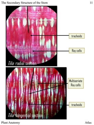 Multiseriate Rays ATLASt | PPTX
