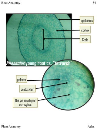 Protoxylem Root ATLASt | PPTX
