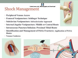 Shock Management
• Peripheral Venous Access
• Femoral Venipuncture: Seldinger Technique
• Subclavian Venipuncture: Infraclavicular Approach
• Internal Jugular Venipuncture: Middle or Central Route
• Intraosseous Puncture/Infusion: Proximal Tibial Route
• Identification and Management of Pelvic Fractures: Application of Pelvic
Binder
• Venous Cutdown
 