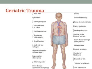Geriatric Trauma
 