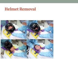 Helmet Removal
 