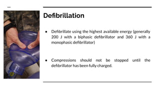 Deﬁbrillation
● Deﬁbrillate using the highest available energy (generally
200 J with a biphasic deﬁbrillator and 360 J with a
monophasic deﬁbrillator)
● Compressions should not be stopped until the
deﬁbrillator has been fully charged.
 