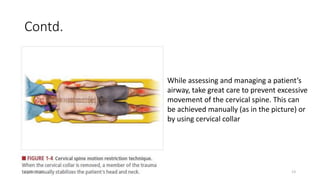 Contd.
While assessing and managing a patient’s
airway, take great care to prevent excessive
movement of the cervical spine. This can
be achieved manually (as in the picture) or
by using cervical collar
07/09/2022 13
 