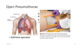 Open Pneumothorax
• Large injuries to the chest wall that remain open can result in a
sucking chest wound causing a disequilibrium in airway pressure
• Air passes preferentially through the chest wall defect with each
inspiration. Effective ventilation is thereby impaired, leading to
hypoxia and hypercarbia.
• Treatment is by
• 3-sided cover over defect
• Chest tube insertion
• Definitive operation
07/09/2022 19
 