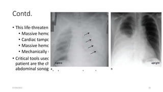 Contd.
• This life-threatening injuries must be identified promptly:
• Massive hemothorax,
• Cardiac tamponade,
• Massive hemoperitoneum,
• Mechanically unstable pelvic fractures with bleeding.
• Critical tools used to differentiate these in the multisystem trauma
patient are the chest and pelvis radiographs, and extended focused
abdominal sonography for trauma (eFAST)
07/09/2022 26
 