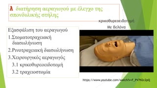 A διατήρηση αεραγωγού με έλεγχο της
σπονδυλικής στήλης
Εξασφάλιση του αεραγωγού
1.Στοματοτραχειακή
διασωλήνωση
2.Ρινοτραχειακή διασωλήνωση
3.Χειρουργικός αεραγωγός
3.1 κρικοθυρεοειδoτομή
3.2 τραχειοστομία
κρικοθυρεοειδoτομή
Με βελόνα
https://www.youtube.com/watch?v=F_PV7N2c2pQ
 