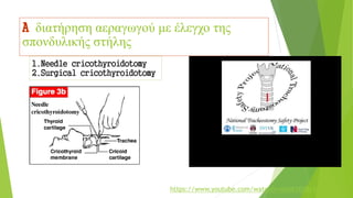 A διατήρηση αεραγωγού με έλεγχο της
σπονδυλικής στήλης
1.Needle cricothyroidotomy
2.Surgical cricothyroidotomy
https://www.youtube.com/watch?v=nehK1E00yZo
 