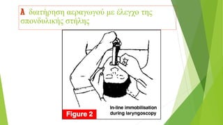 A διατήρηση αεραγωγού με έλεγχο της
σπονδυλικής στήλης
 