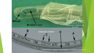 υποδηλώνει ότι το υλικό της
συσκευής έχει δοκιμαστεί σε
μυ κουνελιού, για να
διασφαλιστεί η συμβατότητα
των ιστών
ΣΤΟΜΑΤΙΚΗ /ΡΙΝΙΚΗ
Ραδιοαδιαφανής γραμμή: Για να βοηθήσει την ανίχνευση στις ακτίνες Χ
 