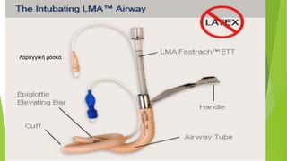 Λαρυγγική μάσκα
 