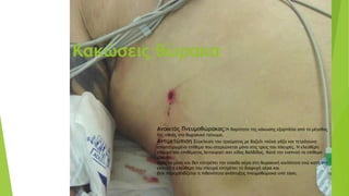 Κακώσεις θώρακα
Ανοικτός Πνευμοθώρακας:Η βαρύτητα της κάκωσης εξαρτάται από το μέγεθος
της οποής στο θωρακικό τοίχωμα.
Αντιμετώπιση Σύγκλειση του τραύματος με βαζελι νούχα γάζα και τετράγωνο
αποστειρωμένο επίθεμα που στερεώνεται μόνο στις τρεις του πλευρές. Η ελεύθερη
πλευρά του επιθέματος λειτουργεί σαν είδος βαλβίδας. Κατά την εισπνοή το επίθεμα
έλκεται
προς τα μέσα και δεν επιτρέπει την είσοδο αέρα στη θωρακική κοιλότητα ενώ κατά την
εκπνοή η ελεύθερη του πλευρά επιτρέπει τη διαφυγή αέρα και
έτσι παρεμποδίζεται η πιθανότητα ανάπτυξης πνευμοθώρακα υπό τάση.
 