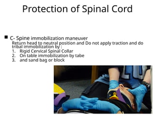 Protection of Spinal Cord
 C- Spine immobilization maneuver
Return head to neutral position and Do not apply traction and do
tribal immobilization by :
1. Rigid Cervical Spinal Collar
2. On table immobilization by tabe
3. and sand bag or block
18
 