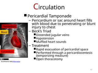 Circulation
Pericardial Tamponade
– Pericardium or sac around heart fills
with blood due to penetrating or blunt
injury to chest
– Beck’s Triad
Distended jugular veins
Hypotension
Muffled heart sounds
– Treatment
Rapid evacuation of pericardial space
Performed through a pericardiocentesis
(temporizing measure)
Open thoracotomy
H
e
a
r
t
Blood
Pericardium
Epicardium
Aceofhearts1968(Wikimedia)
43
 