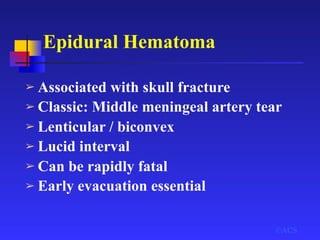 Epidural Hematoma
➢ Associated with skull fracture
➢ Classic: Middle meningeal artery tear
➢ Lenticular / biconvex
➢ Lucid interval
➢ Can be rapidly fatal
➢ Early evacuation essential
©ACS
 