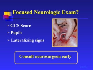 Focused Neurologic Exam?
➢ GCS Score
©ACS
Consult neurosurgeon early
➢ Pupils
➢ Lateralizing signs
 