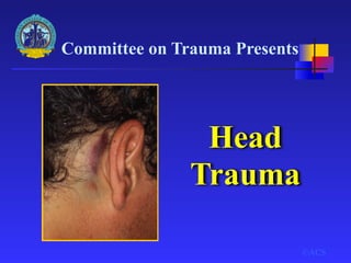 Committee on Trauma Presents
©ACS
Head
Trauma
 