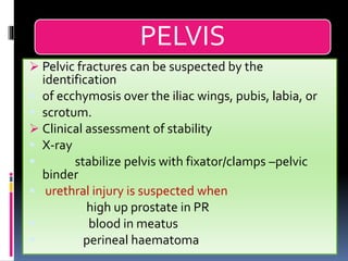 PELVIS
➢ Pelvic fractures can be suspected by the
identification
▪ of ecchymosis over the iliac wings, pubis, labia, or
▪ scrotum.
➢ Clinical assessment of stability
▪ X-ray
▪ stabilize pelvis with fixator/clamps –pelvic
binder
▪ urethral injury is suspected when
high up prostate in PR
▪ blood in meatus
▪ perineal haematoma
 