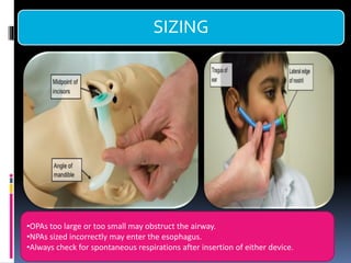 SIZING
•OPAs too large or too small may obstruct the airway.
•NPAs sized incorrectly may enter the esophagus.
•Always check for spontaneous respirations after insertion of either device.
 